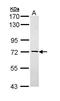 NME/NM23 Family Member 8 antibody, GTX111512, GeneTex, Western Blot image 