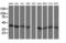 Mitogen-Activated Protein Kinase Kinase 3 antibody, LS-C787749, Lifespan Biosciences, Western Blot image 