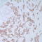 Mucin 1, Cell Surface Associated antibody, TA327672, Origene, Immunohistochemistry frozen image 