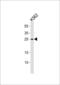 Ras-related protein Rab-27A antibody, 60-957, ProSci, Western Blot image 