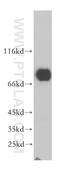 Mitochondrial Antiviral Signaling Protein antibody, 14341-1-AP, Proteintech Group, Western Blot image 