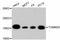 Translocase Of Outer Mitochondrial Membrane 20 antibody, STJ113067, St John