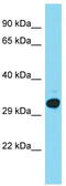 Kinetochore Localized Astrin (SPAG5) Binding Protein antibody, TA333584, Origene, Western Blot image 