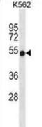 WASP antibody, abx031070, Abbexa, Western Blot image 