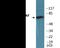 Raf-1 Proto-Oncogene, Serine/Threonine Kinase antibody, EKC2150, Boster Biological Technology, Western Blot image 