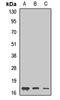 Glia Maturation Factor Beta antibody, LS-C667812, Lifespan Biosciences, Western Blot image 