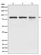 Junction Plakoglobin antibody, M01901-1, Boster Biological Technology, Western Blot image 
