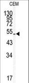 Kruppel Like Factor 5 antibody, LS-C100522, Lifespan Biosciences, Western Blot image 