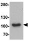 Mindbomb E3 Ubiquitin Protein Ligase 1 antibody, GTX31573, GeneTex, Western Blot image 