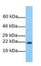 N(Alpha)-Acetyltransferase 50, NatE Catalytic Subunit antibody, GTX46161, GeneTex, Western Blot image 