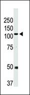 Bone Morphogenetic Protein Receptor Type 2 antibody, PA5-11863, Invitrogen Antibodies, Western Blot image 