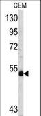 MYCN Proto-Oncogene, BHLH Transcription Factor antibody, LS-B13751, Lifespan Biosciences, Western Blot image 