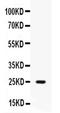 Peptidase Inhibitor 3 antibody, PA5-79818, Invitrogen Antibodies, Western Blot image 