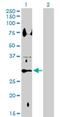 Hydroxysteroid 11-Beta Dehydrogenase 1 antibody, H00003290-D01P, Novus Biologicals, Western Blot image 