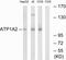 ATPase Na+/K+ Transporting Subunit Alpha 2 antibody, GTX87004, GeneTex, Western Blot image 