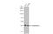 Keratin 5 antibody, GTX113219, GeneTex, Western Blot image 