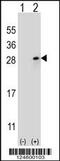 Fibroblast Growth Factor 9 antibody, 55-089, ProSci, Western Blot image 