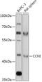 Cyclin I antibody, 18-012, ProSci, Western Blot image 