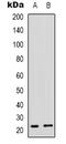 Mitochondrial Ribosomal Protein L48 antibody, LS-C368685, Lifespan Biosciences, Western Blot image 