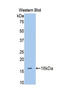 Endoglin antibody, LS-C293742, Lifespan Biosciences, Western Blot image 