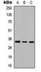 Adenosine A2b Receptor antibody, orb234999, Biorbyt, Western Blot image 