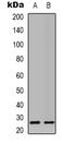Mitochondrial Ribosome Recycling Factor antibody, LS-C368785, Lifespan Biosciences, Western Blot image 