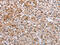 ETFB antibody, CSB-PA267720, Cusabio, Immunohistochemistry paraffin image 