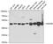 Hydroxyacyl-CoA Dehydrogenase Trifunctional Multienzyme Complex Subunit Beta antibody, 19-811, ProSci, Western Blot image 