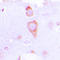 Guanylate Cyclase 1 Soluble Subunit Beta 1 antibody, LS-C352293, Lifespan Biosciences, Immunohistochemistry paraffin image 