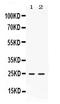 Fibroblast growth factor 15 antibody, PB10062, Boster Biological Technology, Western Blot image 