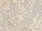 Cullin 4B antibody, PA1233, Boster Biological Technology, Immunohistochemistry frozen image 