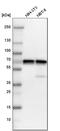 Serine/threonine-protein kinase PAK 1 antibody, HPA003565, Atlas Antibodies, Western Blot image 