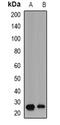 Placental Growth Factor antibody, abx142140, Abbexa, Western Blot image 