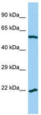 Mitochondrial Ribosomal Protein L14 antibody, TA331699, Origene, Western Blot image 