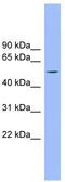 Transmembrane And Coiled-Coil Domains 6 antibody, TA344849, Origene, Western Blot image 