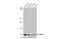 Ribonucleotide Reductase Catalytic Subunit M1 antibody, GTX636578, GeneTex, Western Blot image 