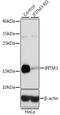 Interferon Induced Transmembrane Protein 3 antibody, GTX35214, GeneTex, Western Blot image 