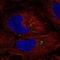 Insulin gene enhancer protein ISL-2 antibody, NBP2-57938, Novus Biologicals, Immunofluorescence image 