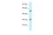 Integral Membrane Protein 2C antibody, A08857, Boster Biological Technology, Western Blot image 