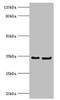 Rabies virus Phosphoprotein antibody, orb241180, Biorbyt, Western Blot image 