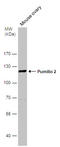 Pumilio homolog 2 antibody, GTX114172, GeneTex, Western Blot image 