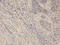 Aldo-Keto Reductase Family 1 Member C3 antibody, A01820, Boster Biological Technology, Immunohistochemistry frozen image 