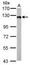 Hexokinase 2 antibody, NBP2-16814, Novus Biologicals, Western Blot image 