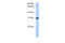 Trinucleotide Repeat Containing 18 antibody, ARP51744_P050, Aviva Systems Biology, Western Blot image 