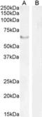 Forkhead Box C2 antibody, NB100-1269, Novus Biologicals, Western Blot image 