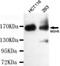 MutS Homolog 6 antibody, GTX49251, GeneTex, Western Blot image 