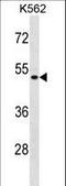 Enolase Superfamily Member 1 antibody, LS-C167763, Lifespan Biosciences, Western Blot image 