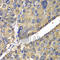 Carboxylesterase 1 antibody, A1853, ABclonal Technology, Immunohistochemistry paraffin image 