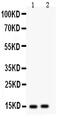 Fatty Acid Binding Protein 5 antibody, GTX11725, GeneTex, Western Blot image 