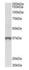 Methionine Adenosyltransferase 2B antibody, orb12330, Biorbyt, Western Blot image 